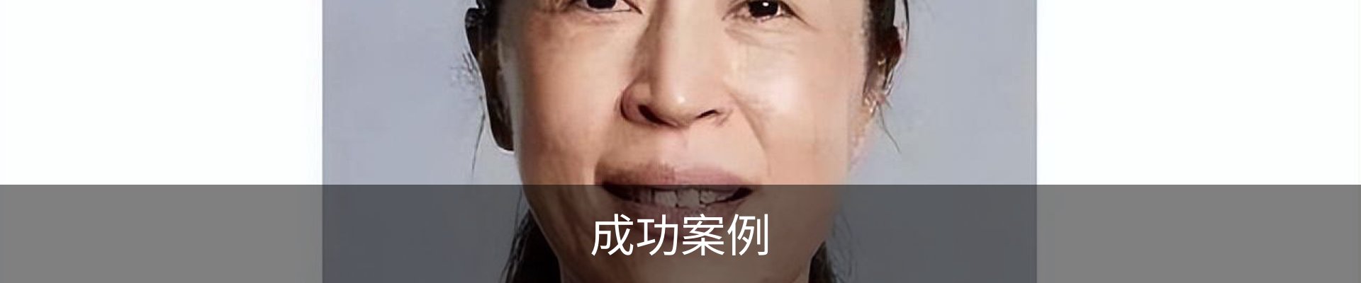 成功案例